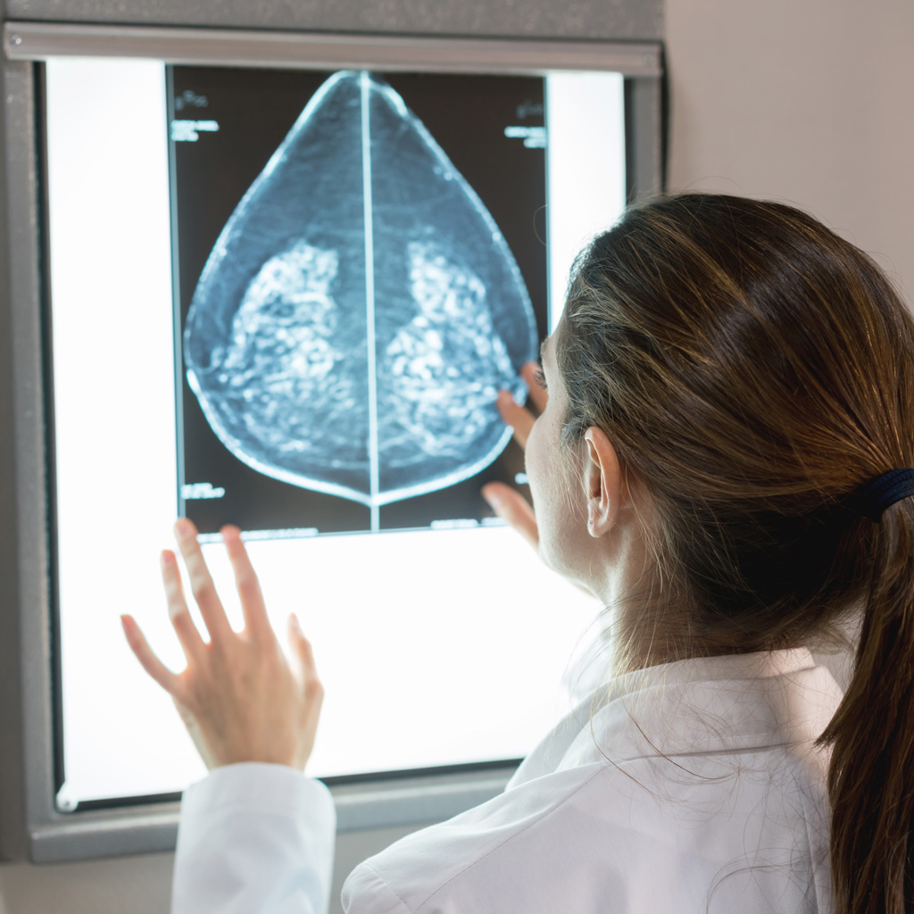 Doctor Reviewing Mammogram