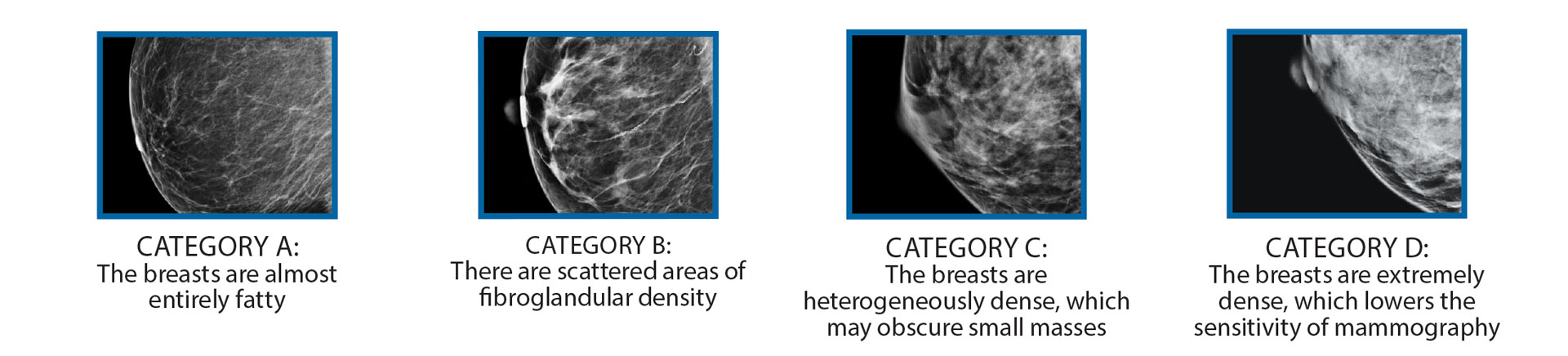 Breast Densities